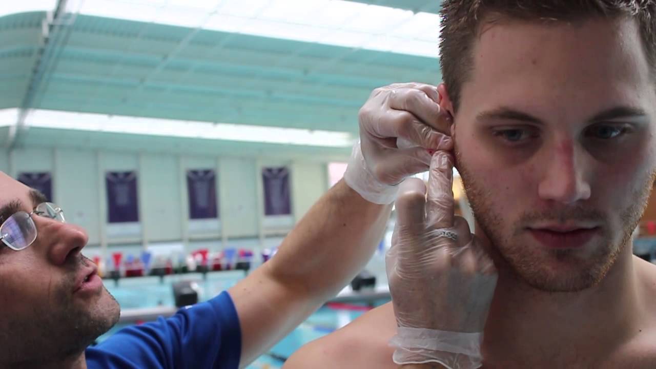 Lactate Testing