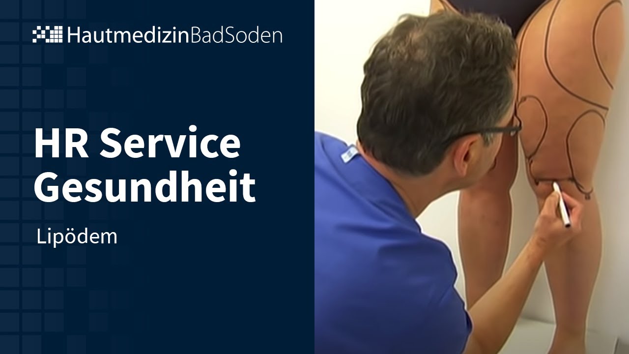 HR Service Gesundheit: Lipödem