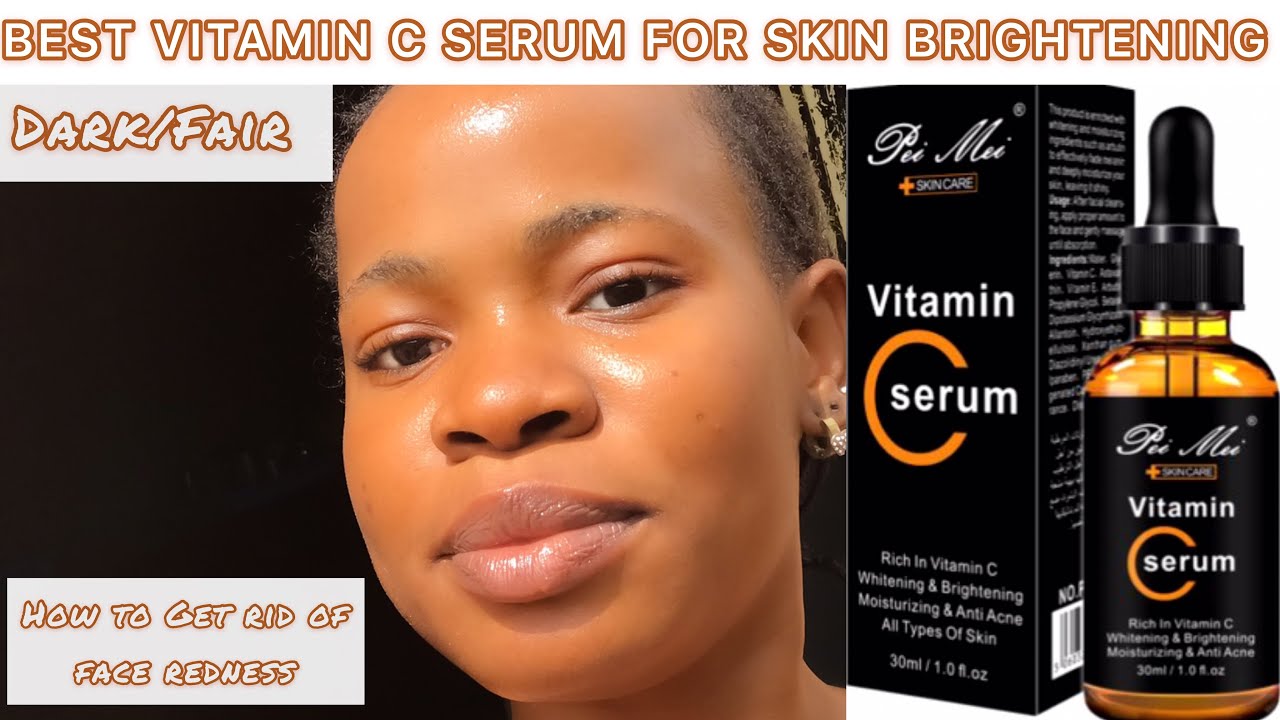 BEST VITAMIN C SERUM FOR SKIN BRIGHTENING : How To Use Vitamin C Serum In Your Skin Care Routine