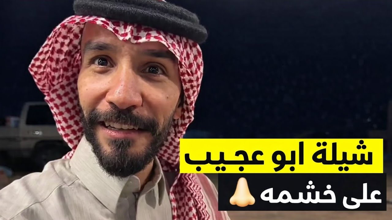 شيلة ابو عجيب على خشمه قبل وبعد 😂 سنابات ابو حصة 