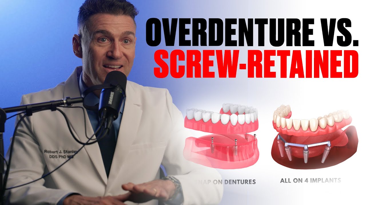 WHAT'S BEST For Your Patients: Implant Overdenture or Screw-Retained All-On-X?