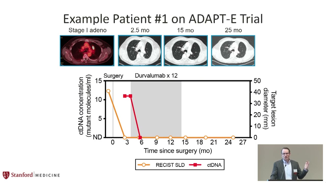 Minimal Residual Disease Testing in Early Stage Lung Cancer – Maximilian Diehn