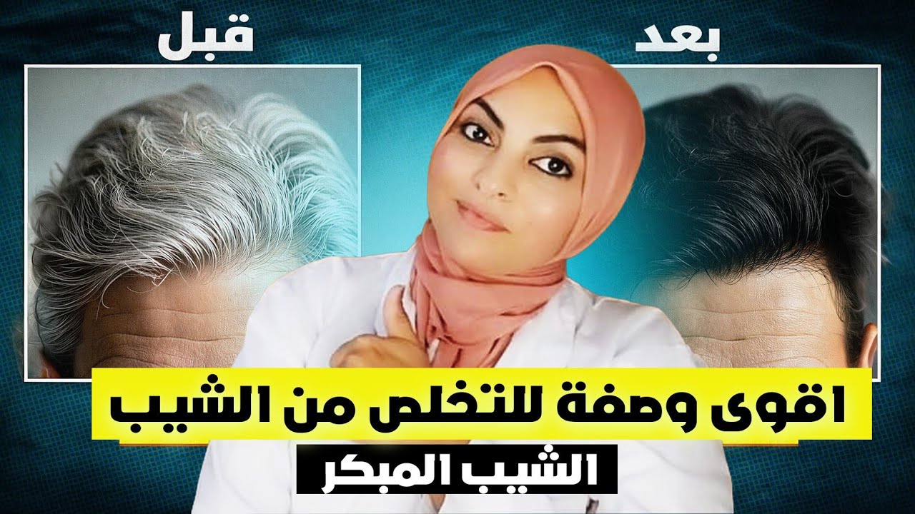 أقوى وصفة للتخلص من الشيب