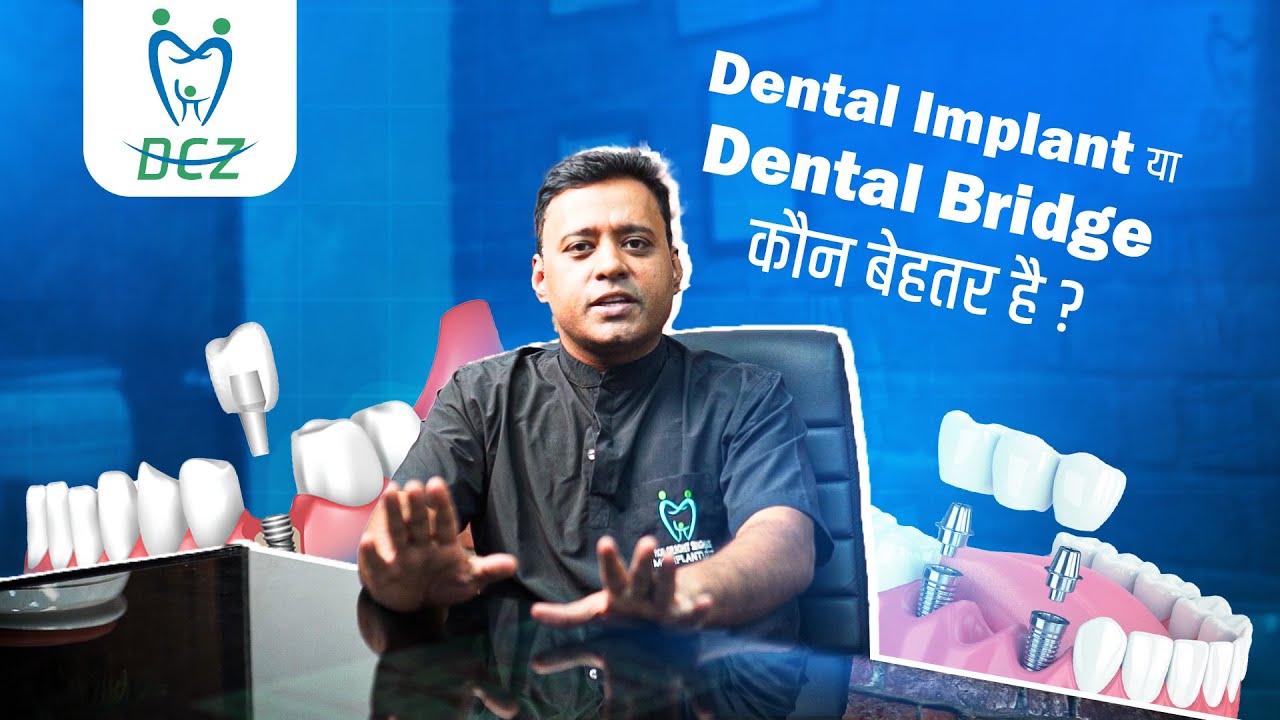 डेंटल इम्प्लांट या डेंटल ब्रिज: कौन सा चुनें?| Dental Implant vs Dental Bridge | Dental Comfort Zone