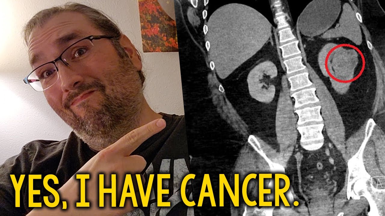 Yes, I Have Cancer.