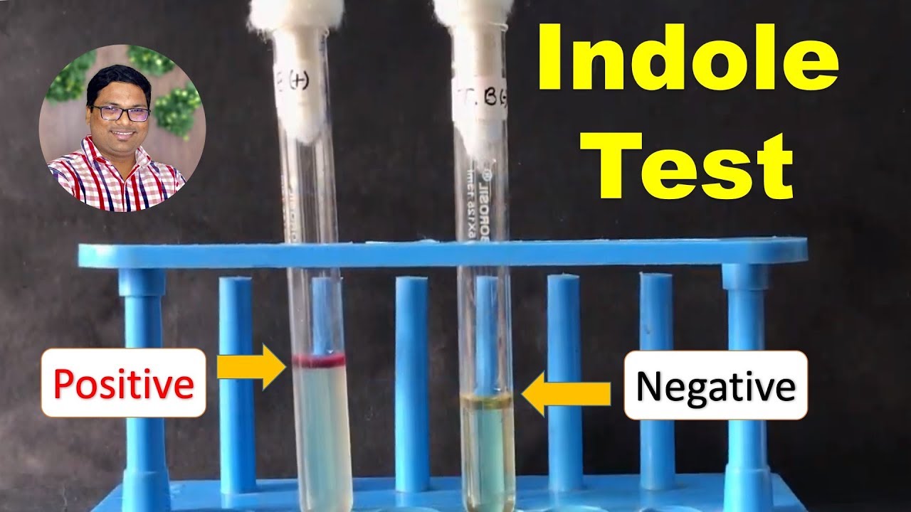 Bacterial Identification Tests: Indole Test