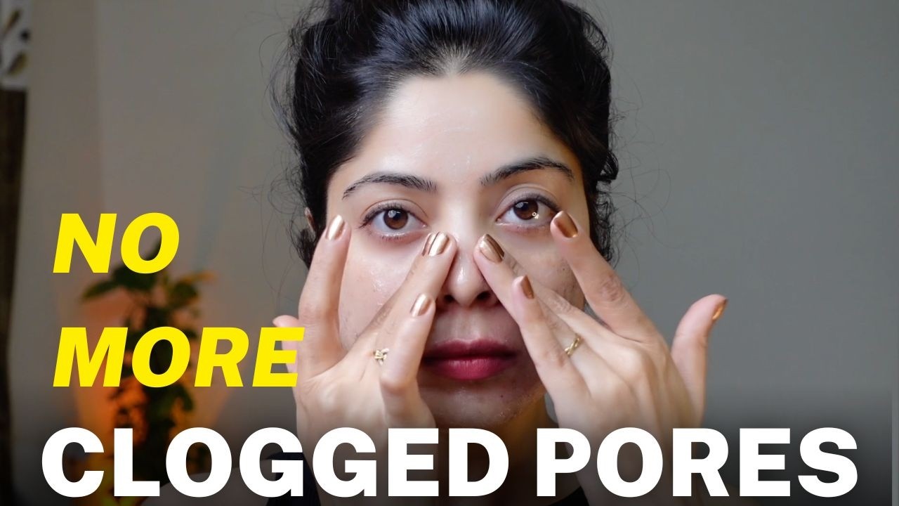 5 Proven Steps to Clear Sebaceous Filaments, Blackheads & Comedonal Acne !