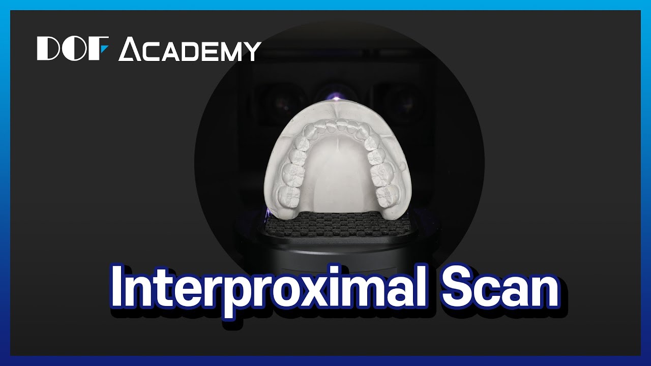 Interproximal Scan