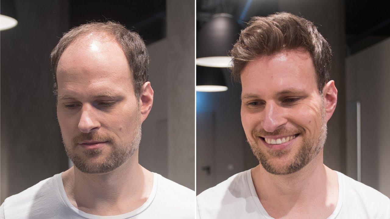 Kurzhaar Frisur mit Haarsystem | Hair Transformation | Hairsystems Heydecke