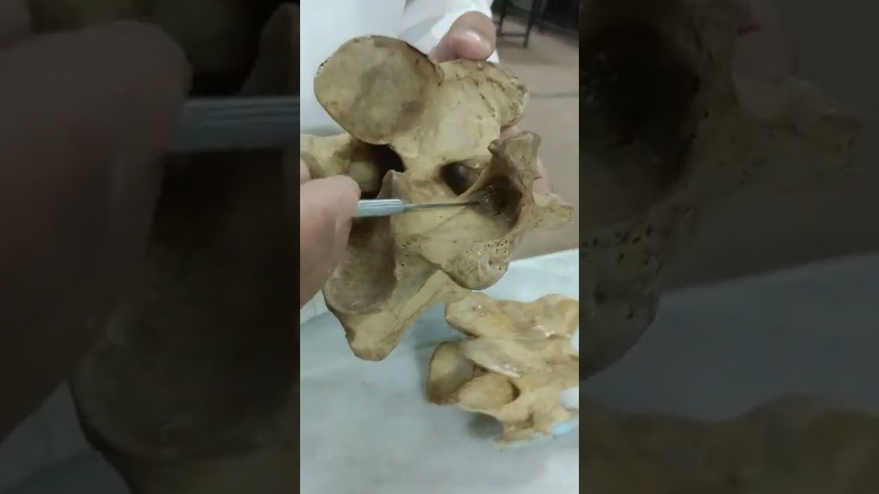 3rd,4th,5th,6th and last cervical vertebrae دكتور رمضان ساري