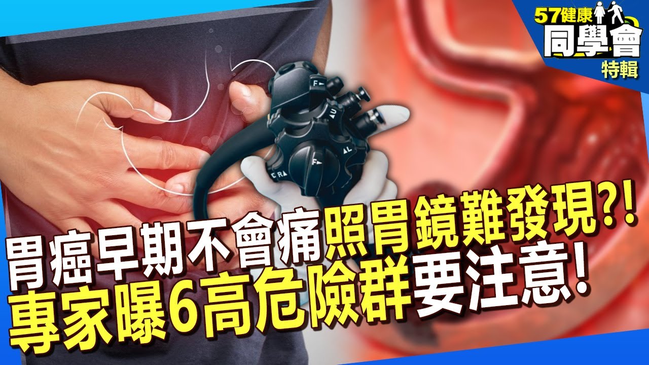 【精選】胃癌早期不會痛「連照胃鏡都難發現」？！胃脹氣恐是患病前兆？專家曝6高危險群要注意【57健康同學會】