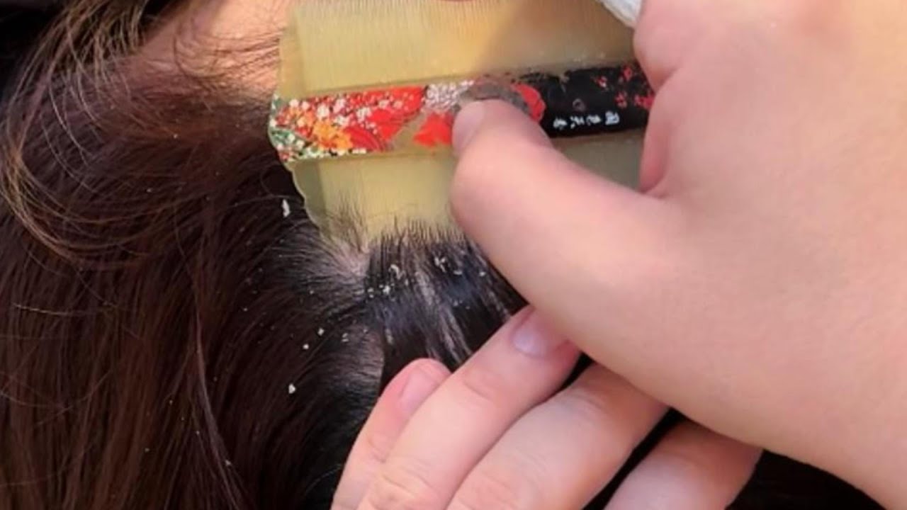 Jojo’s ASMR Scalp Care — Gentle Fine-Comb Lines for Deep Relaxation | No Talking