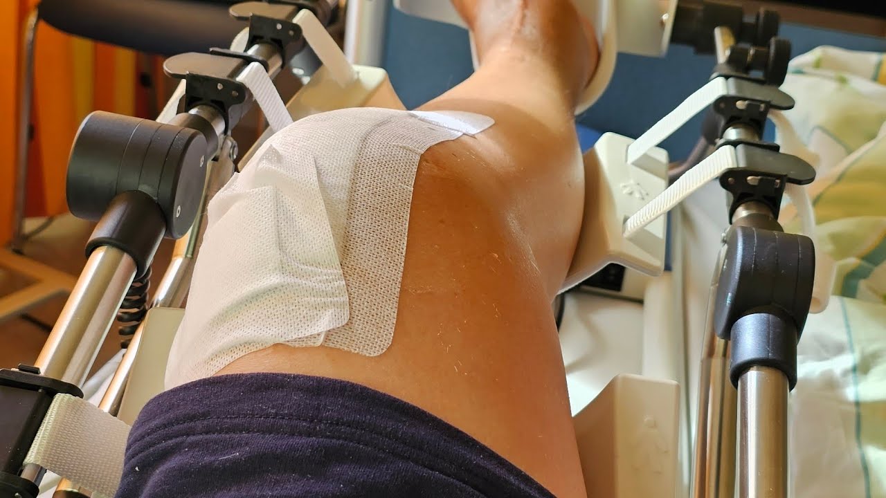 knie-Op im Kreiskrankenhaus Weilburg