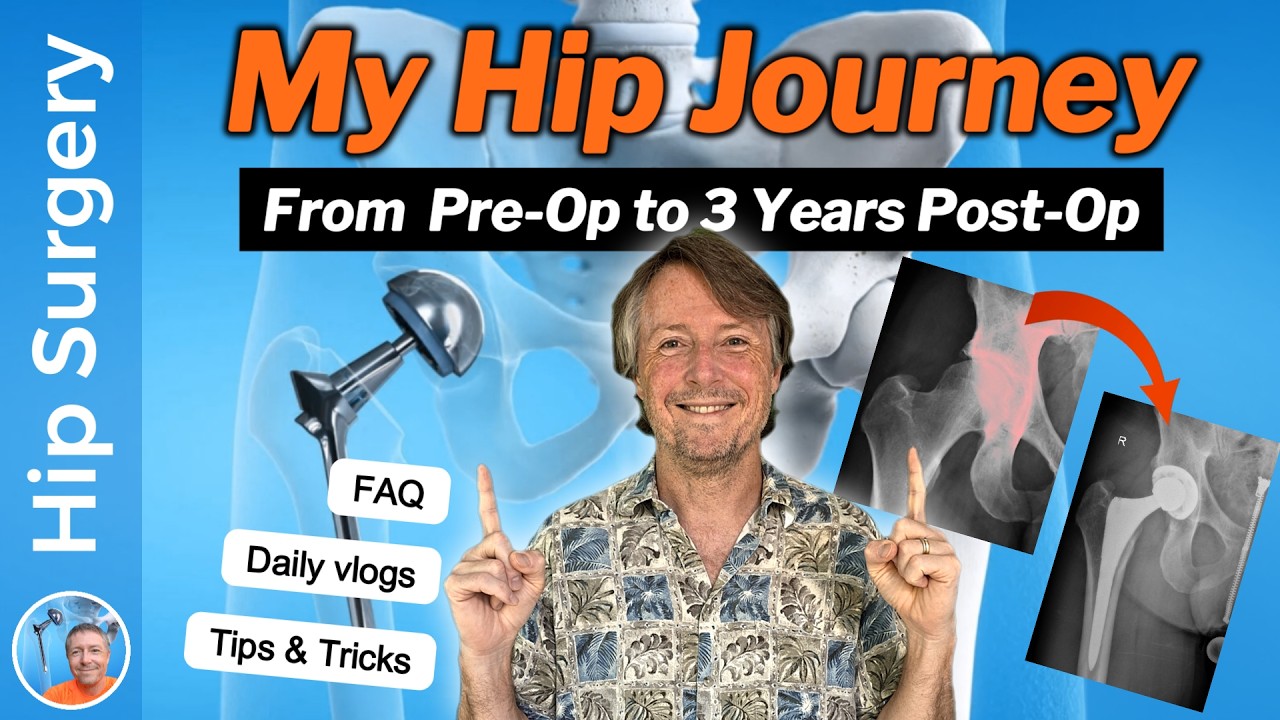 My Hip Journey from Diagnosis to 3 Years Post-Op