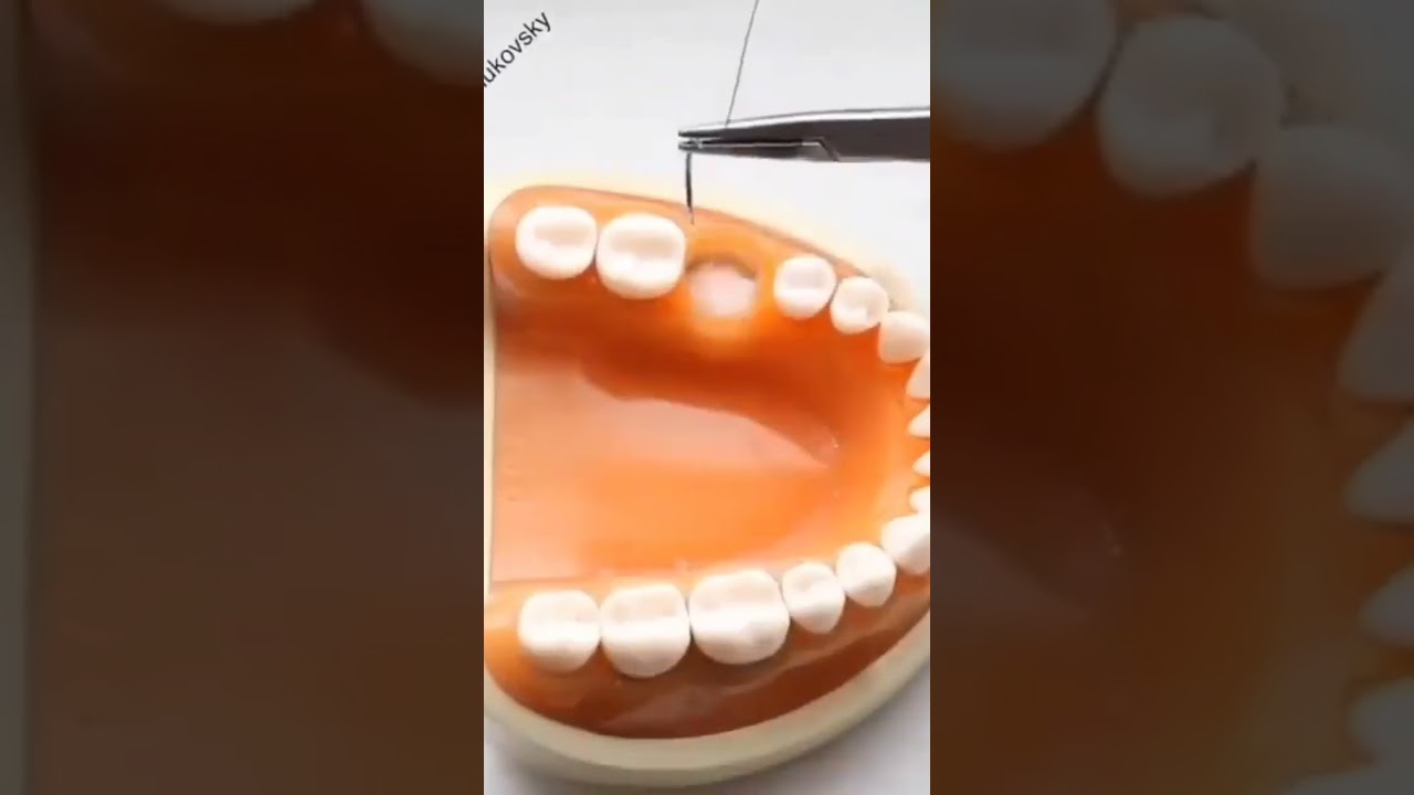 Let&rsquo;s try a Figure of Eight Suture📽@davidzhukovsky#dentist#implantsurgery#dentalhygienist#suturing