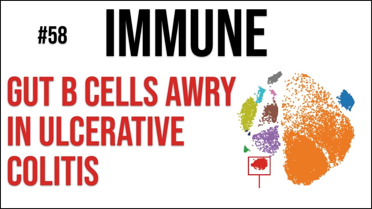 Immune 58: Gut B cells awry in ulcerative colitis