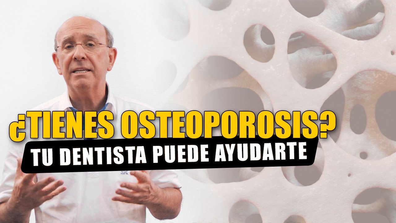 Qué es la osteoporosis y cómo afecta a tu salud oral