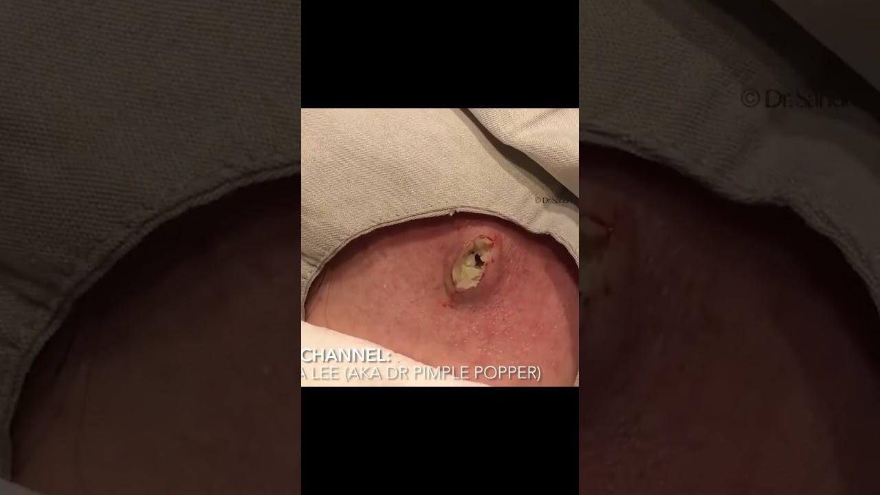 What do you think of the results? ⁠⁠Watch the whole procedure at the link in bio!⁠⁠✌️❤️💥