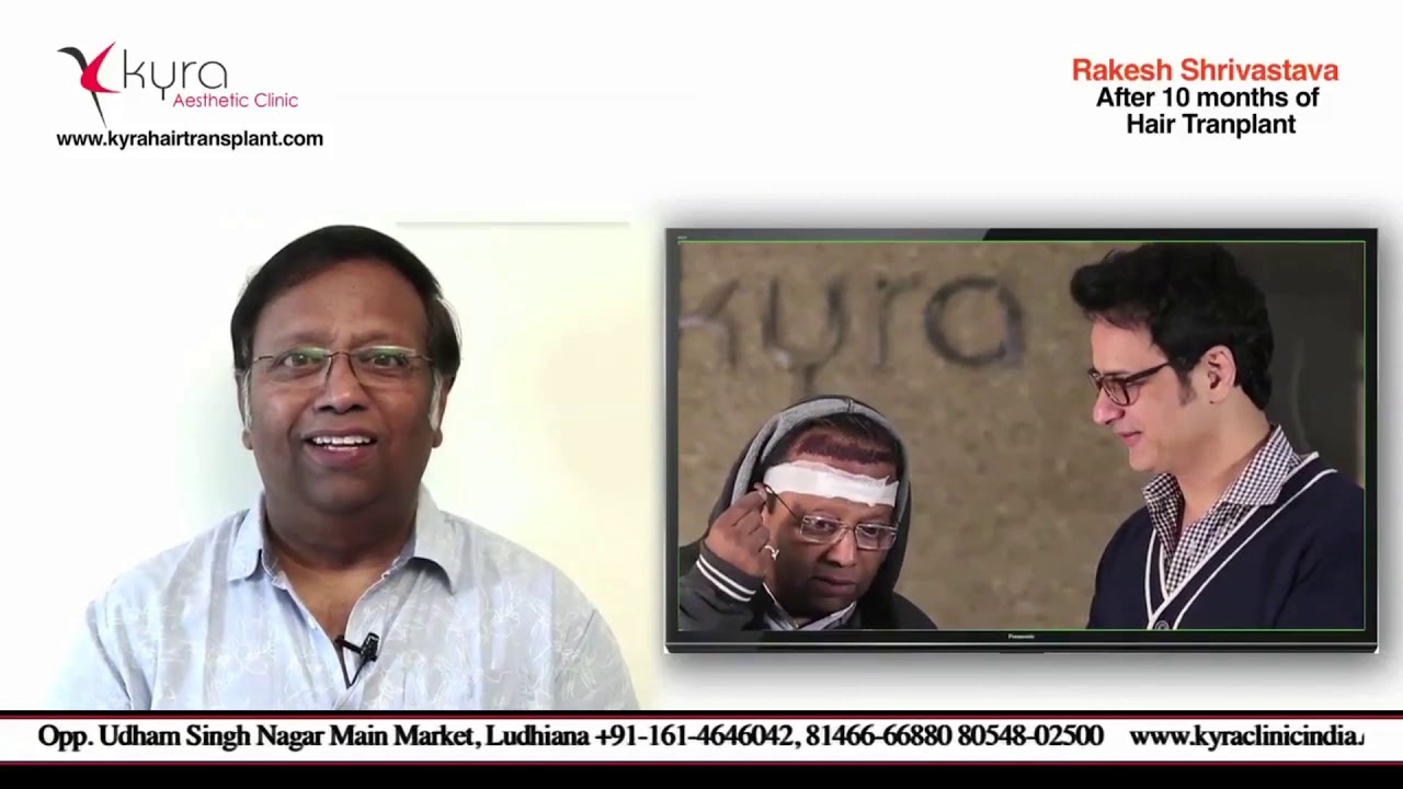 Actor Rakesh Shrivastav's Hair Transplant at Kyra Clinic