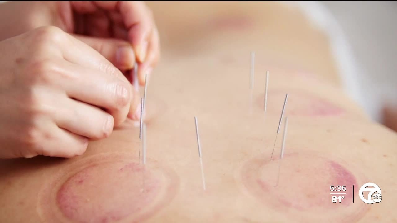 Ask Dr Nandi: Is acupuncture a way to treat debilitating backaches?