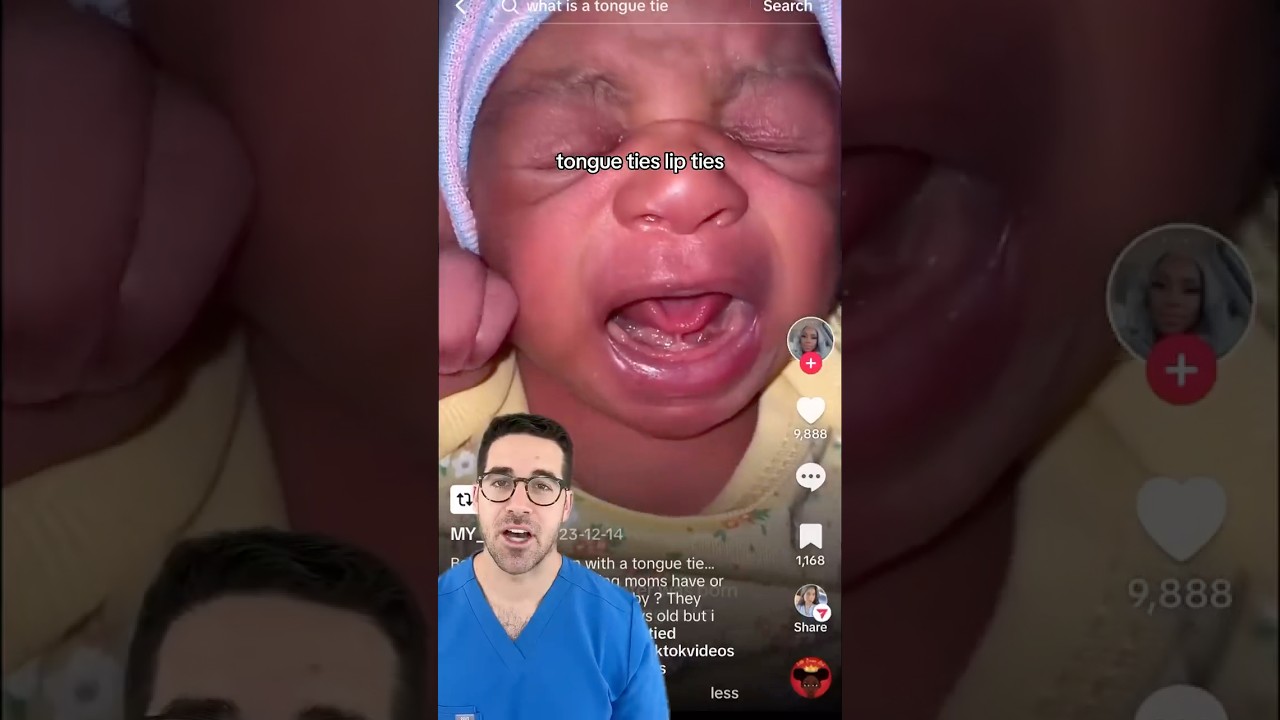 Tongue & Lip Ties in Babies 👅 | What the Evidence Says About When (and If) to Treat
