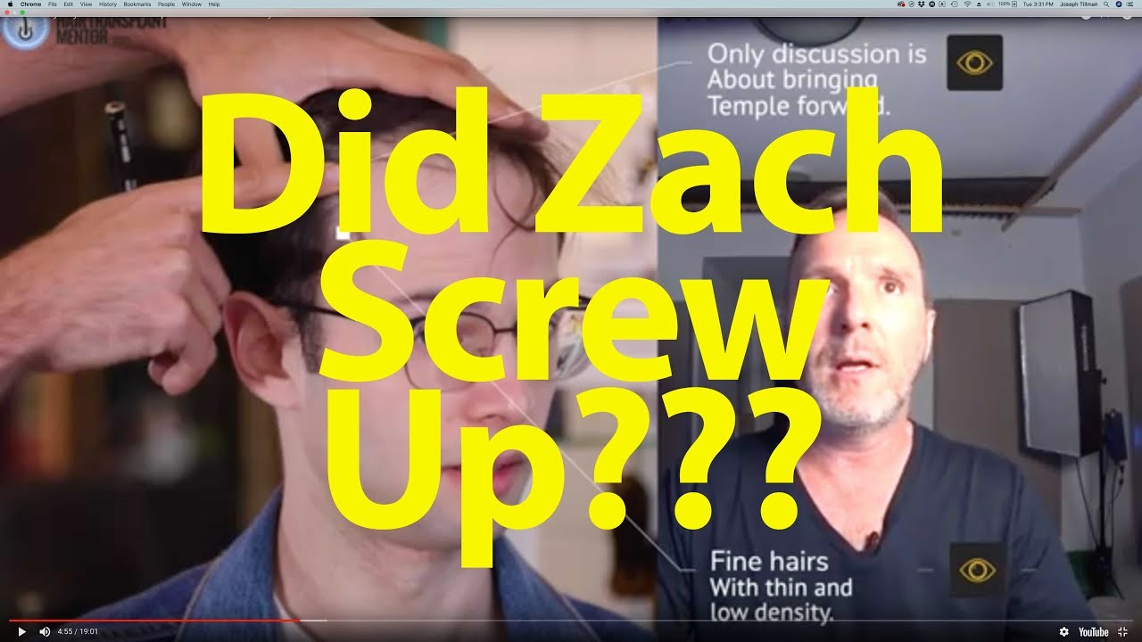 Try Guys Hair Loss Journey Gets Wild!