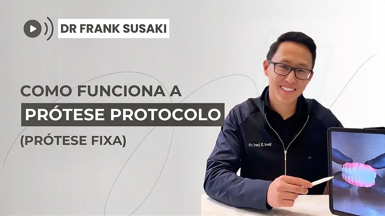 Prótese Protocolo: Tudo o Que Você Precisa Saber Antes de Fazer