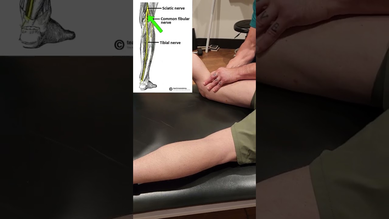 Knee Pain from a Nerve Behind the Knee? Yes&mdash;Watch This! 🧠💥