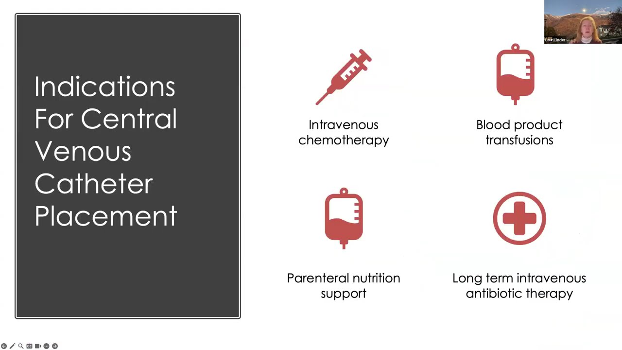 Considerations for Central Venous Catheter Selection and Maintenance Care