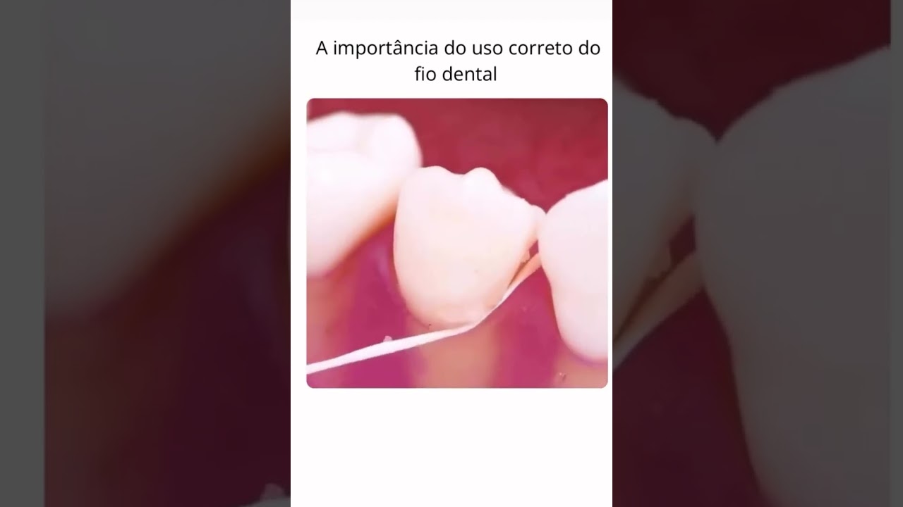 COMO PASSAR O FIO DENTAL #odontologia #dentes #dentista #biologia