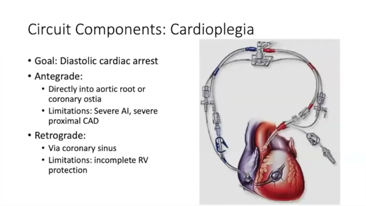 Introduction to Cardiopulmonary Bypass