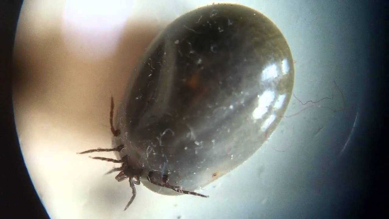 2014-04-23 Zecke durch Mikroskop - Tick with a microscope