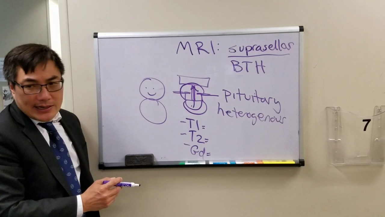 Sellar masses and MRI