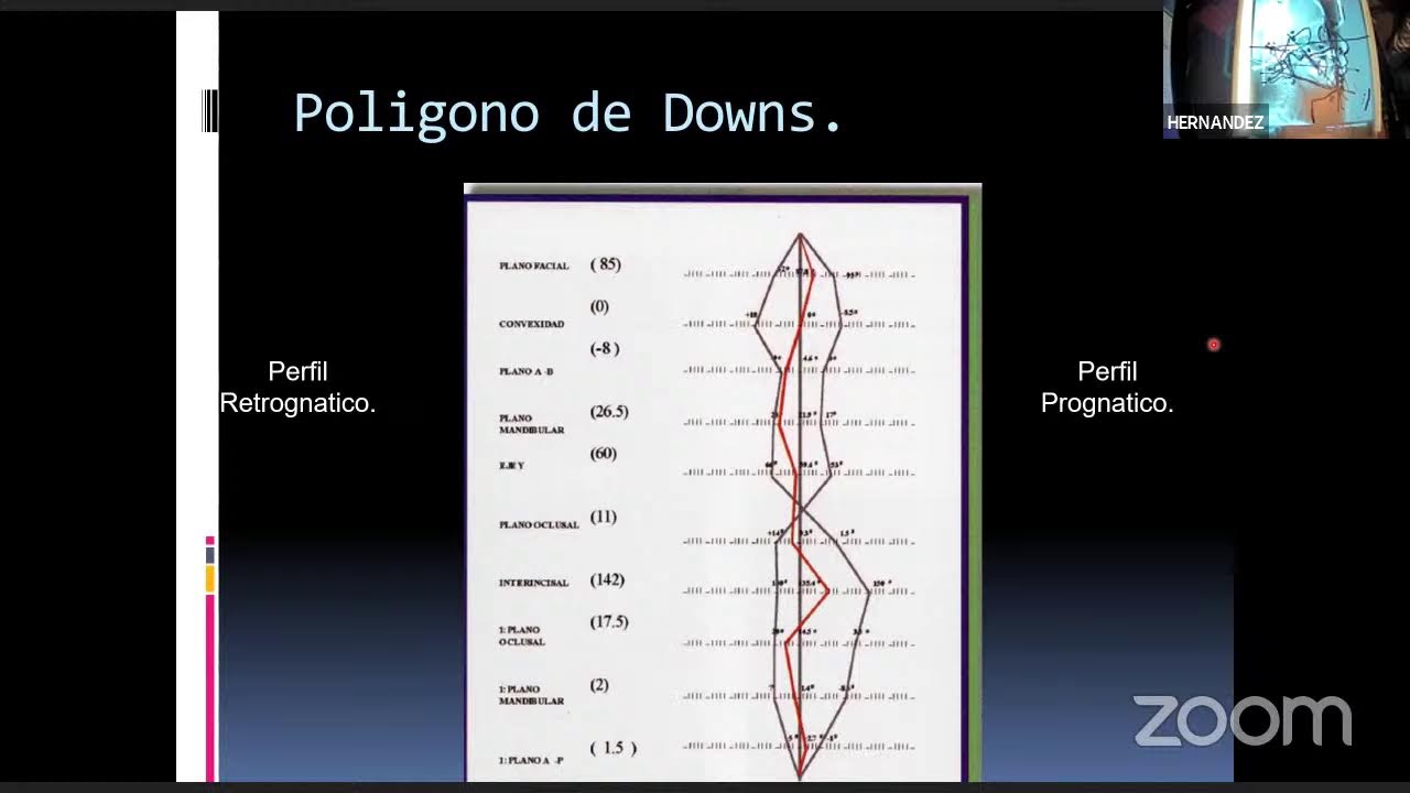 Trazado Analisis de Downs