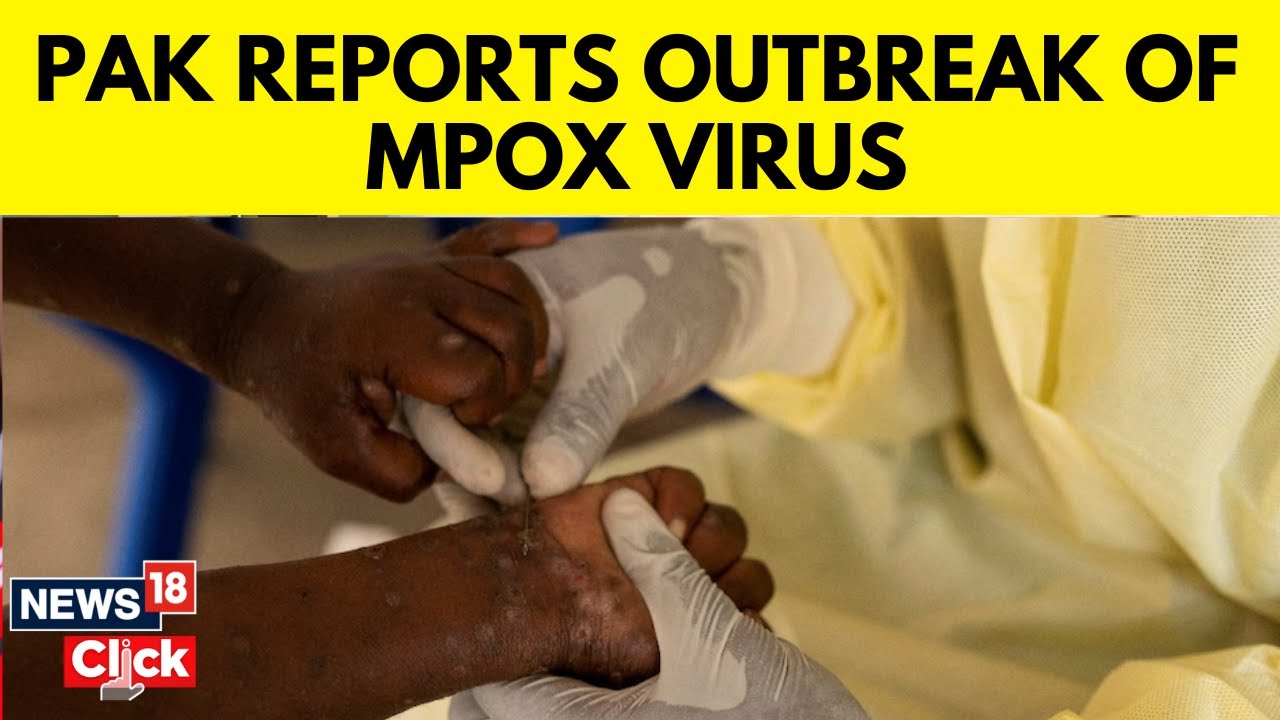 MPox Outbreak Updates: Pakistan Reports First 3 Cases After WHO Declares Global Emergency | N18G