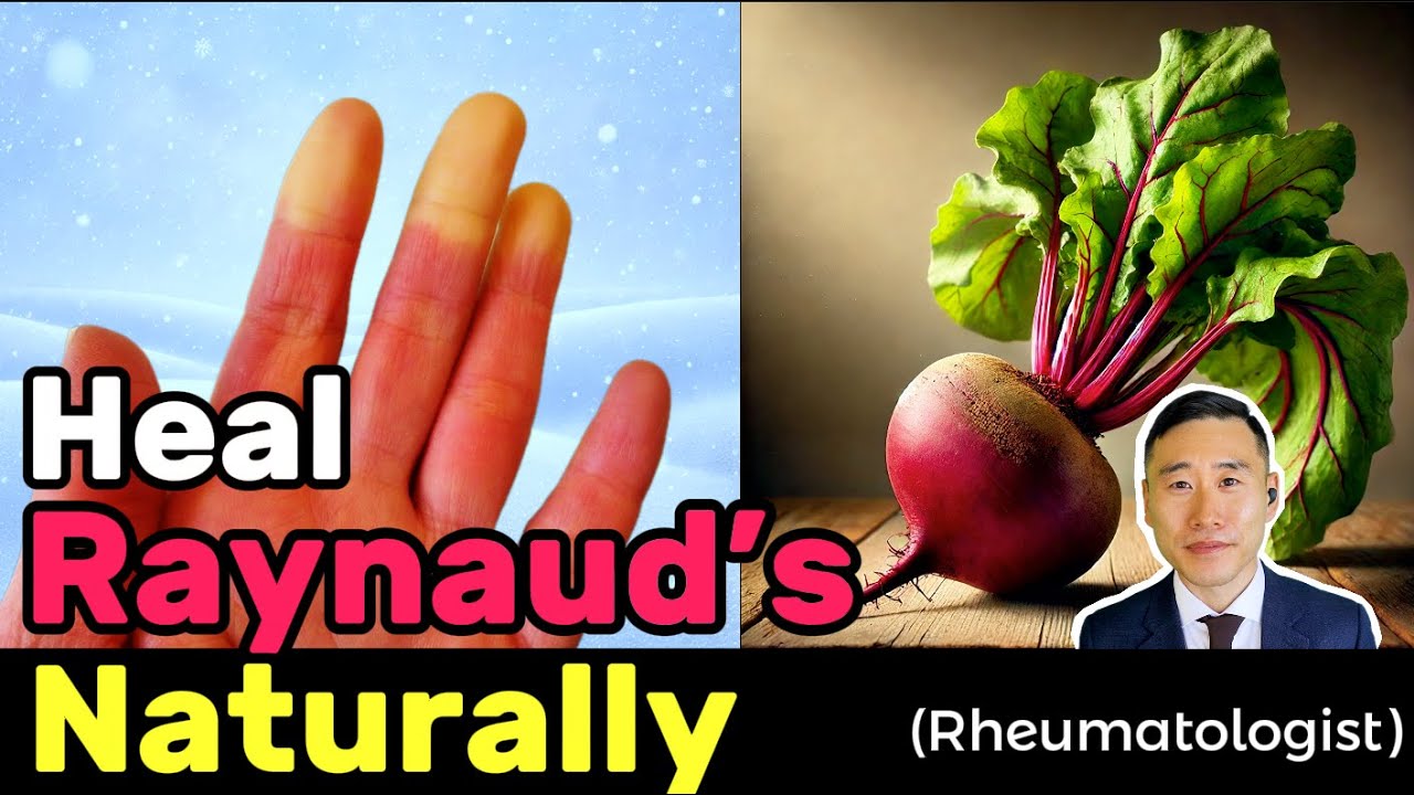 Must-Know Tips to Heal Raynaud&rsquo;s Naturally from an Integrative Rheumatologist