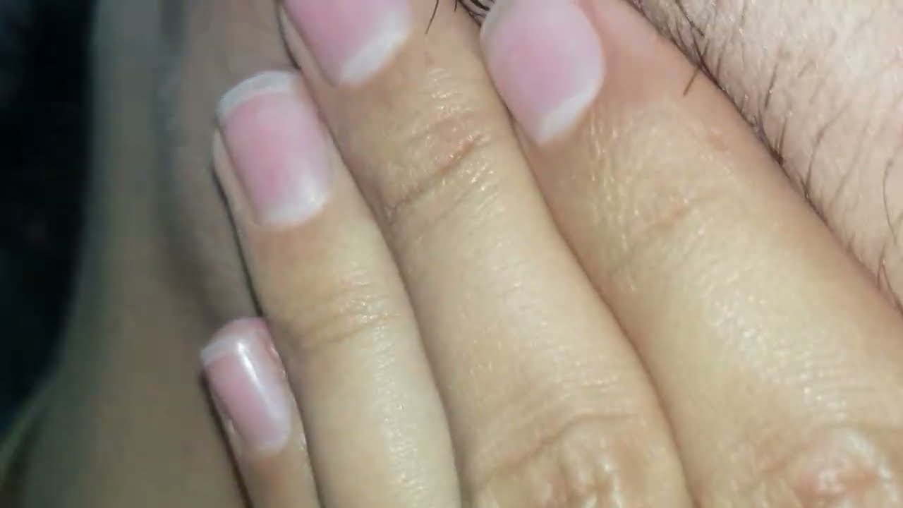 Barber massage therapy ASMR satisfying | Ingrown hair Treatment | Blackheads removal