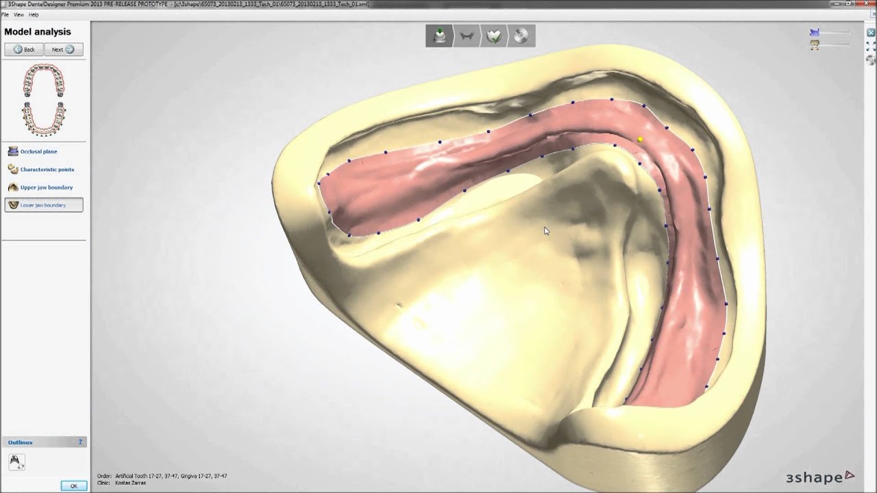 Dental System 2013 - Full Dentures