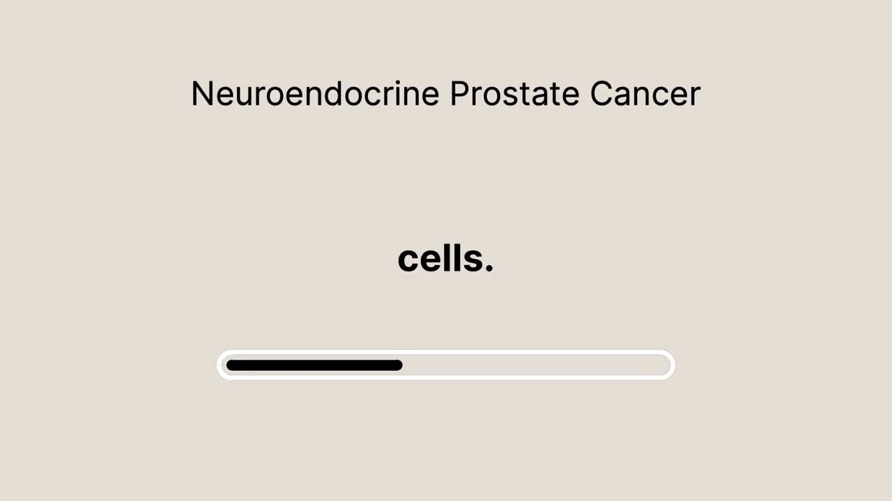 Prostate Cancer Beyond PSA: The Hidden Threat of t-SCNC : Part 1