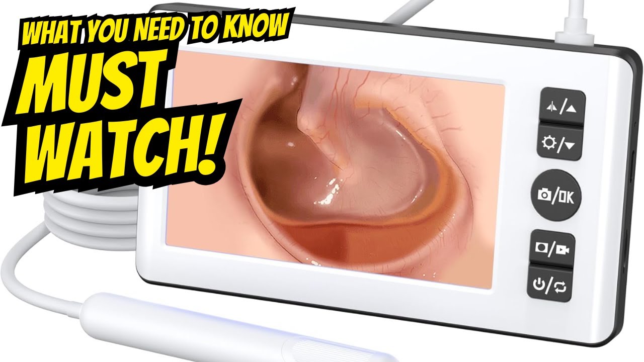 Watch before you buy this ear wax kit!