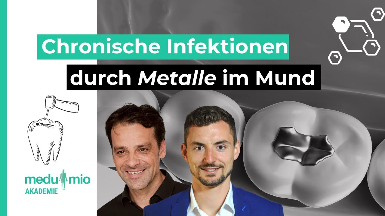 Chronische Infektionen durch Metalle im Mundraum 🦷 Dr. med. dent. Holger Scholz