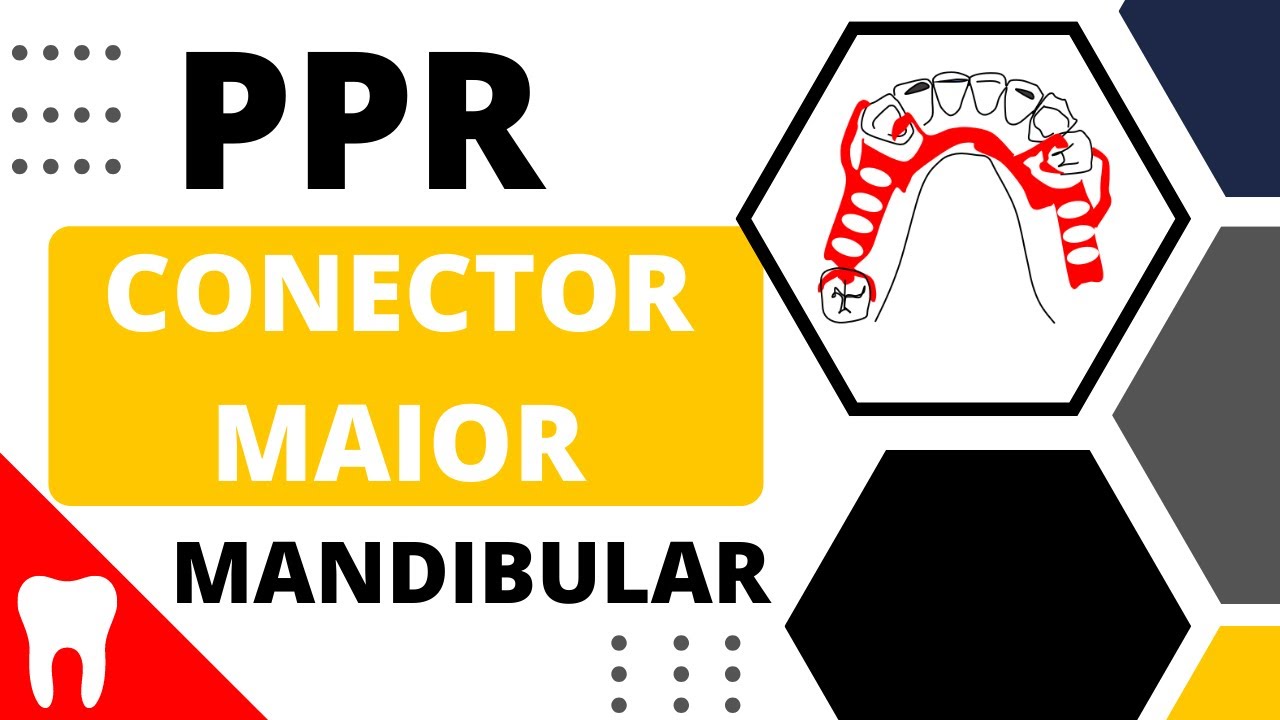 CONECTOR MAIOR MANDIBULAR