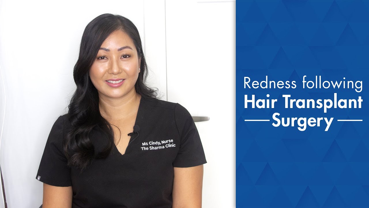 Redness After Hair Transplant Surgery
