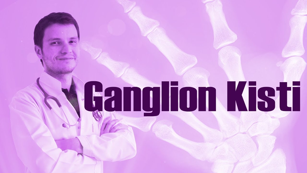 Ganglion Kisti Nedir? | Op. Dr. Ziya Baran Soykan
