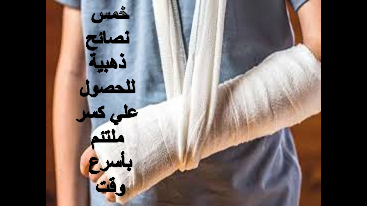 التئام العظام  | خمس نصائح ذهبية للحصول علي كسر ملتئم| التئام الكسور