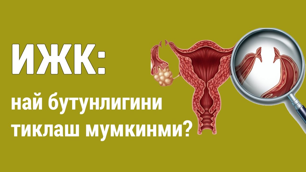 ИЖК: най бутунлигини тиклаш мумкинми