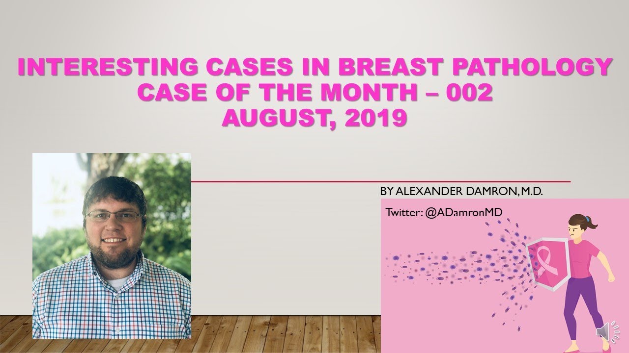 Interesting Cases in Breast Pathology (002) - Case of the Month August, 2019