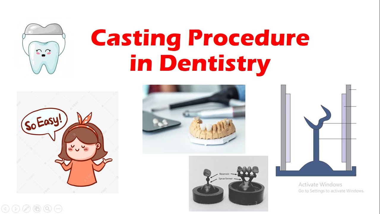 Casting Procedure in Dentistry I NEET-MDS #dentalmaterials #prosthodontics