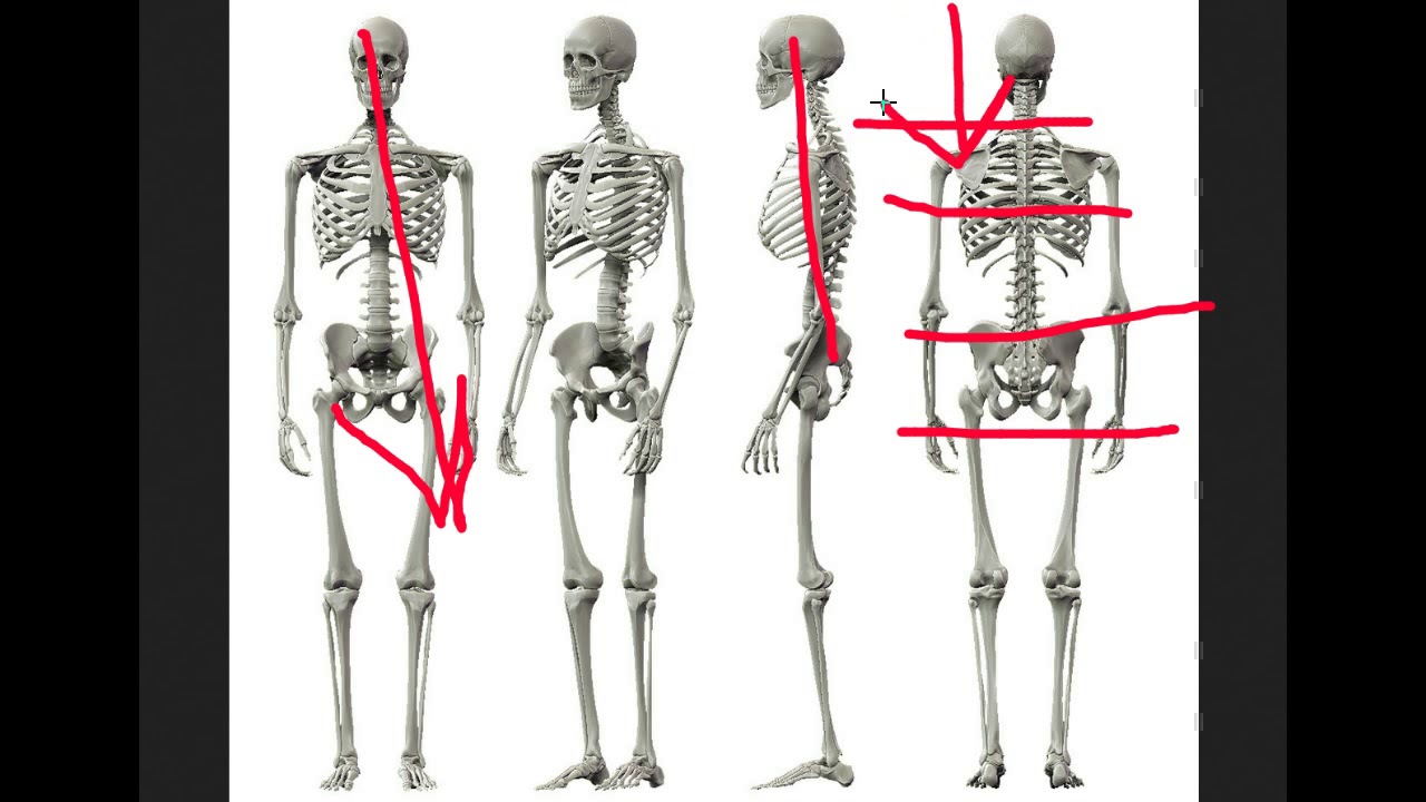 Pudendal Nerve Pain - And Upper Cervical/Structural Chiropractic