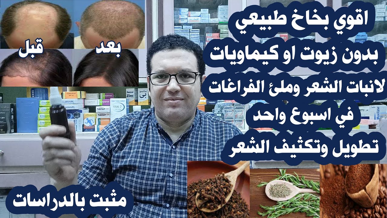 اقوي بخاخ طبيعي لانبات الشعر وملئ فراغات مقدمة الرآس علاج التساقط والصلع الوراثي يعادل المينوكسيديل